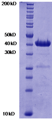 Proteros Product Image - JMJD2C (human) (1-370) 