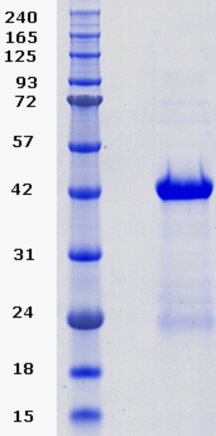 Proteros Product Image - JNK1 (human) (1-364) 