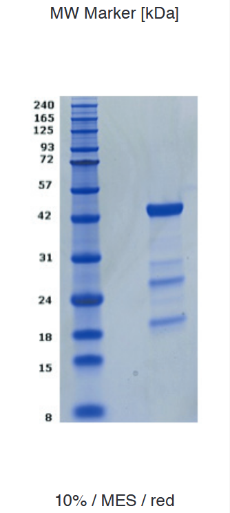 Proteros Product Image - JNK1 (human) (1-384) 