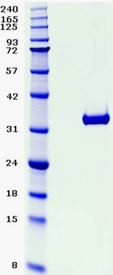 Proteros Product Image - KDR (human) (806-1171) Deletion (940-990) 