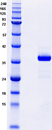 Proteros Product Image - KDR (human) (814-1171) Deletion (940-990 