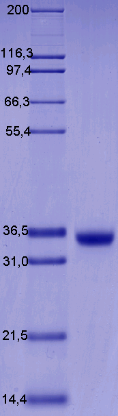 Proteros Product Image - HIS-KDR (human) (806-1171) Deletion (940-990) 