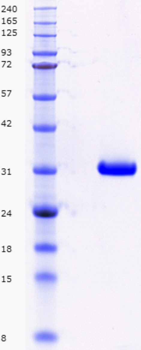 Proteros Product Image - LCK-Kinase (human) (225-501) 