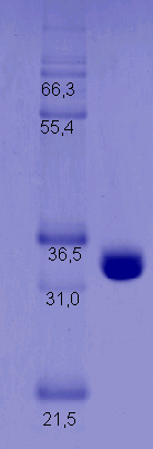 Proteros Product Image - LCK-Kinase (human) (225-509) 