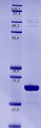 Proteros Product Image - LXR beta (human) (213-461) 