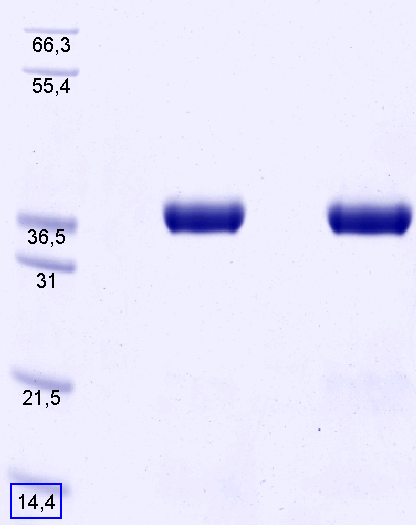 Proteros Product Image - MAPKAP Kinase 2 (human) (41-364) 