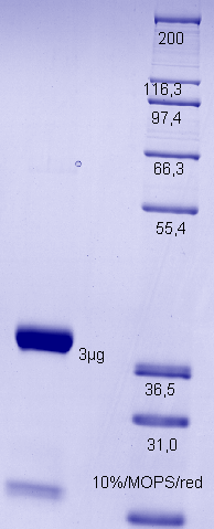 Proteros Product Image - MAPKAP Kinase 2 (human) (41-366) 