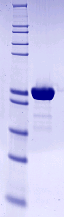 Proteros Product Image - MAPKAP Kinase 2 (human) (47-364), Deletion Mutant (219-237) 