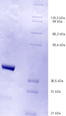 Proteros Product Image - MAPKAP Kinase 2 (human) (47-400) 