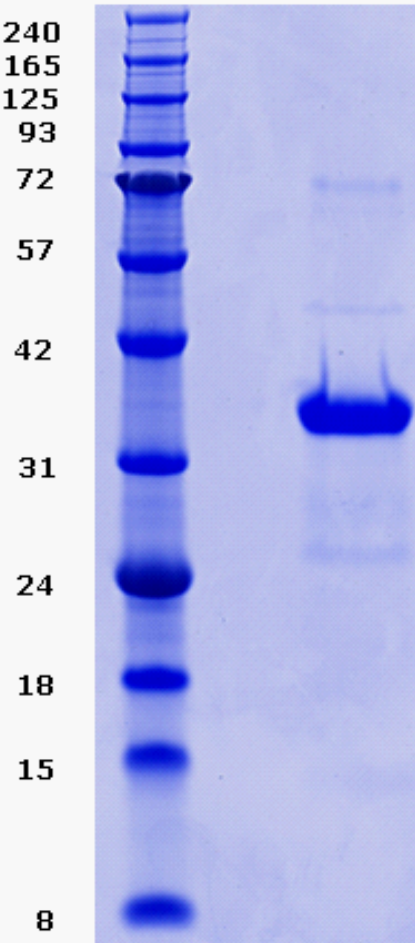 Proteros Product Image - Mnk1 (human) (37-382)-del(165- 205) 