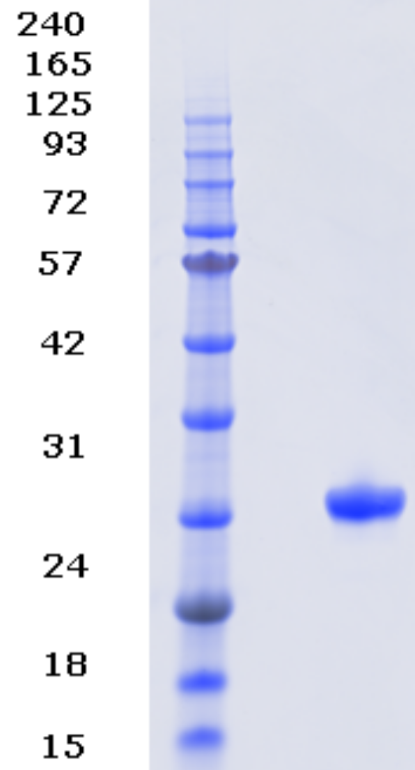 Proteros Product Image - NEK2 (human) (1-271) (T175A) 