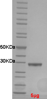 Proteros Product Image - NEK2 (human) (8-271) (T175A) 