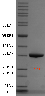 Proteros Product Image - PAK1 (human) (249-545) (K299R, T423E, E503D) 