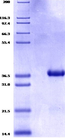 Proteros Product Image - PDE10A (human) (449-789) 