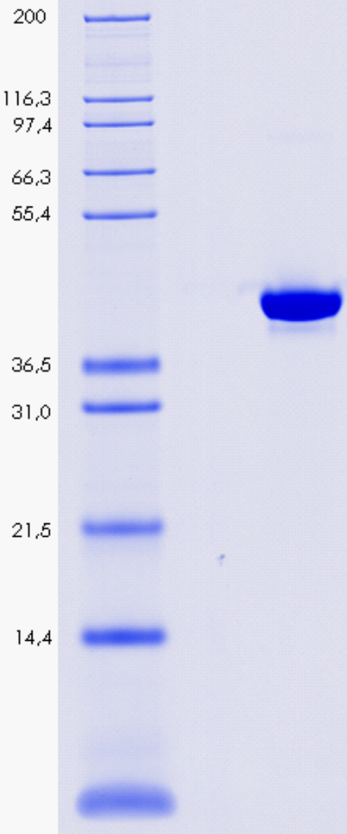 Proteros Product Image - PDE1B (human) (146-502) 