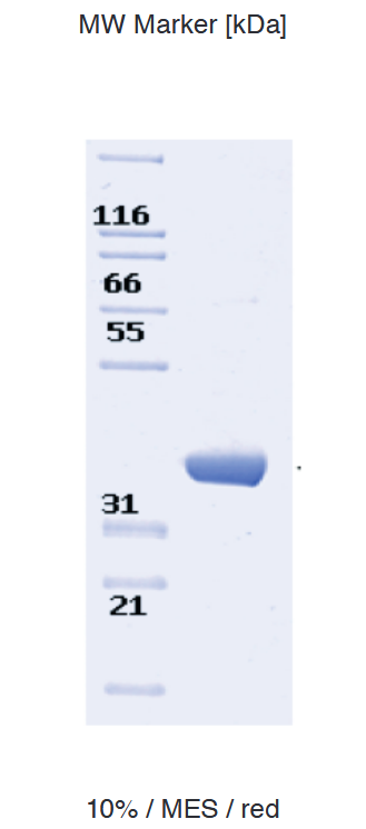 Proteros Product Image - PDE1C (human) (148-529) 