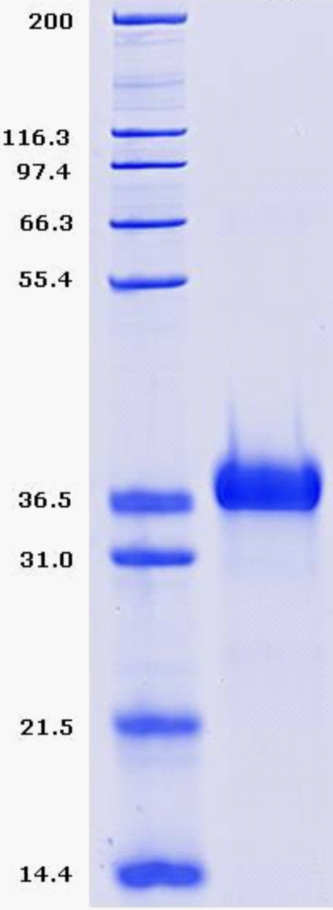 Proteros Product Image - PIM2 (human) (1-311) 