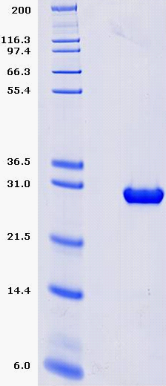 Proteros Product Image - PIM2 (human) (22-288) 