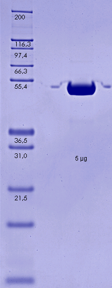 Proteros Product Image - PKBa - AKT1 (human) (1-443) 