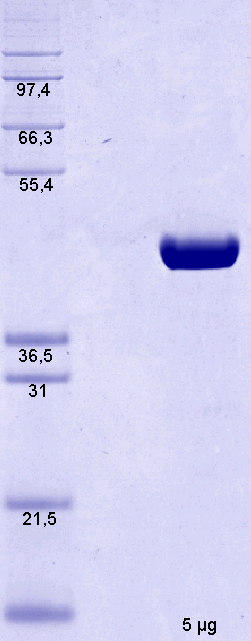 Proteros Product Image - PKC iota (human) (224-587) 