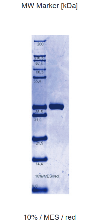 Proteros Product Image - PLK2 (human) (57-362) 