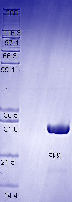 Proteros Product Image - PLK4 (human) (1-271) 