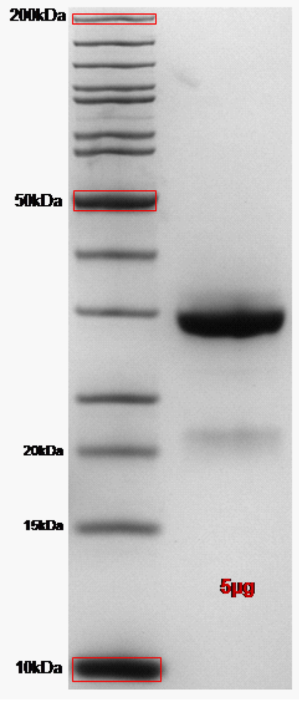 Proteros Product Image - PYK2 (human) (416-692) 