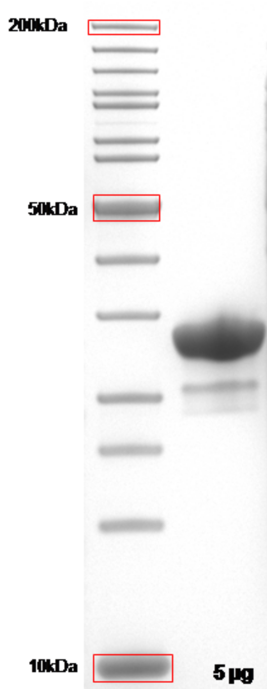 Proteros Product Image - PYK2 (human) (416-698) 