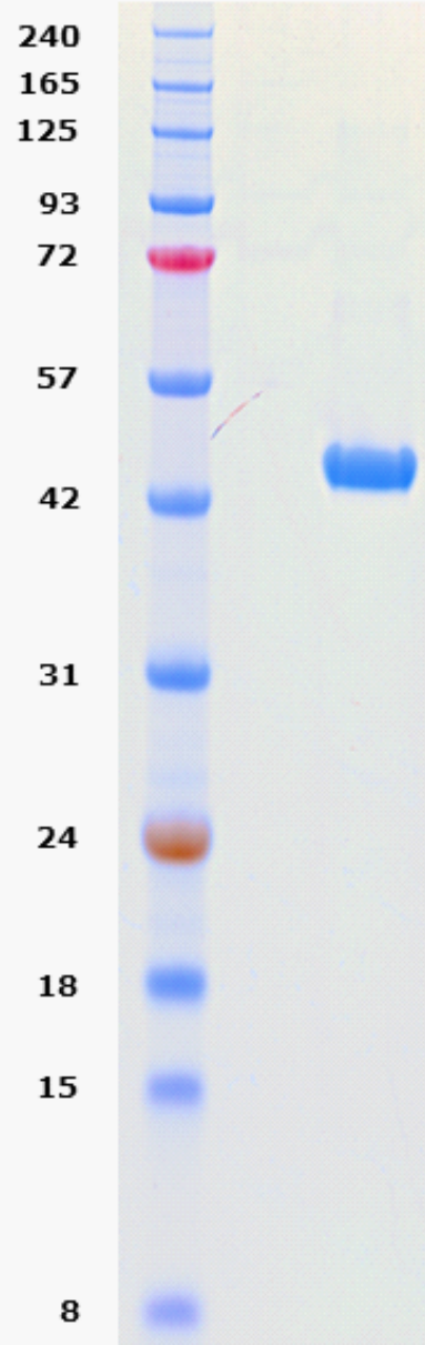 Proteros Product Image - Rho-Kinase I (human) (6-405) 