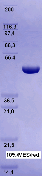 Proteros Product Image - Rho-Kinase I (human) (6-415) 