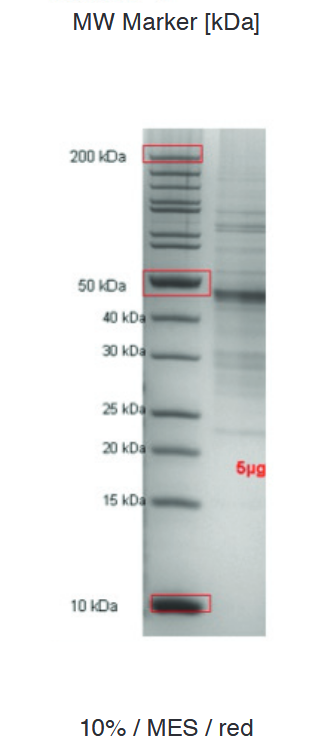 Proteros Product Image - Rho-Kinase II (human) (38-417) 