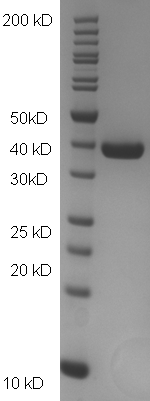 Proteros Product Image - Rho-Kinase II (human) (85-417) 