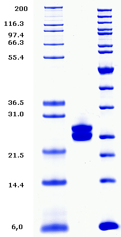 Proteros Product Image - ROR gamma T (human) (265-507) 