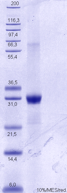 Proteros Product Image - ROS-1 (human) (1942-2235) 