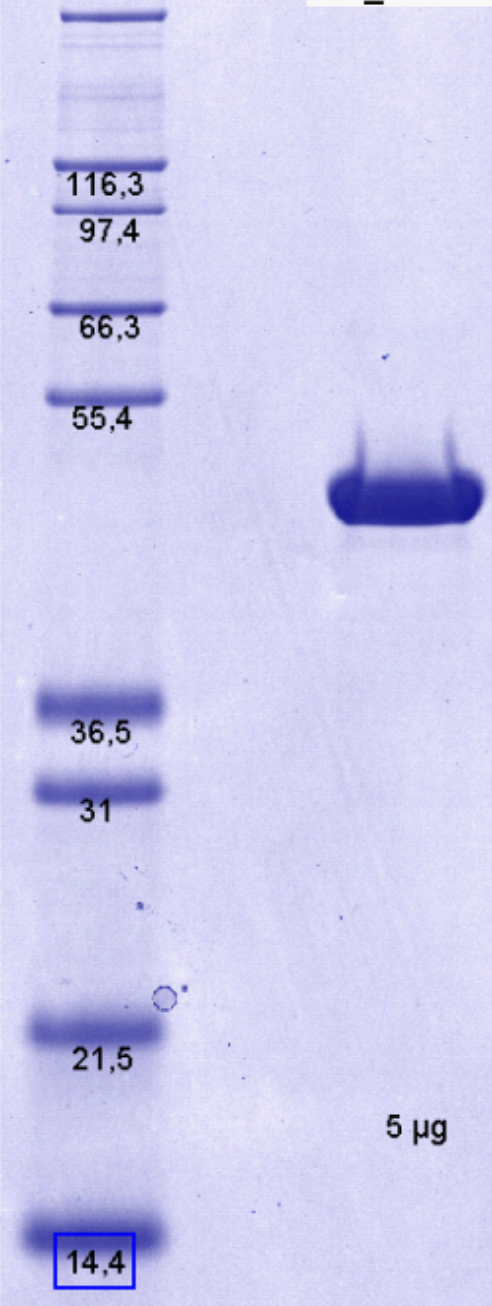 Proteros Product Image - RSK2 (human) (1-391) 