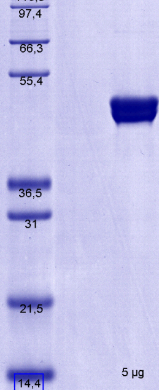 Proteros Product Image - RSK2 (human) (1-401) 