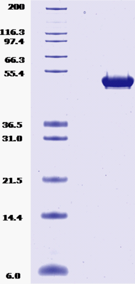 Proteros Product Image - RSK2 (human) (1-417) 