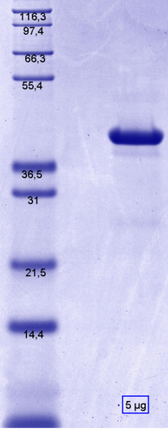 Proteros Product Image - RSK2 (human) (42-389) 