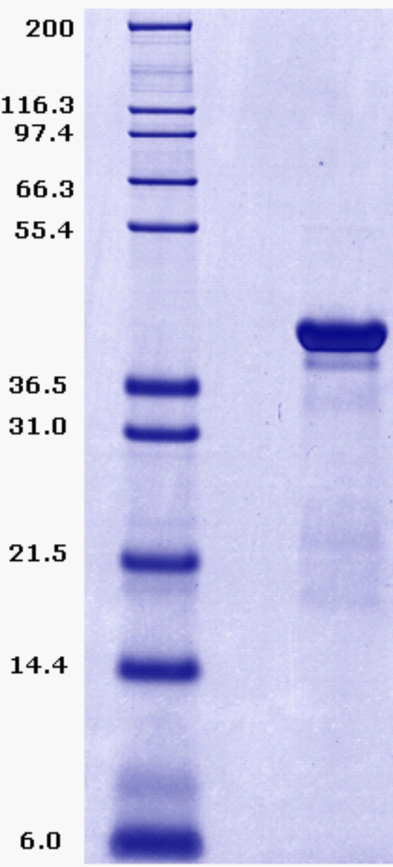 Proteros Product Image - RSK2 (human) (42-389) (S386D) 