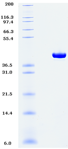 Proteros Product Image - RSK2 (human) (42-389) (S386D, S227D) 