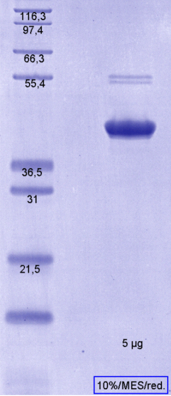 Proteros Product Image - RSK2 (human) (42-401) 