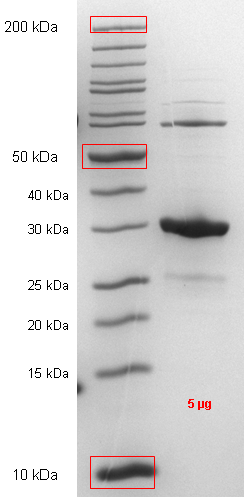 Proteros Product Image - STK33 (human) (101-385) 