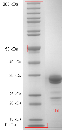 Proteros Product Image - STK33 (human) (109-385) 