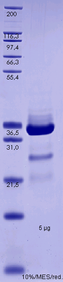 Proteros Product Image - SYK (human) (356-635) 