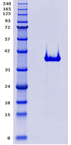 Proteros Product Image - TBK1 (1-308)-HIS (D135N)