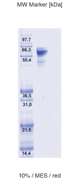 Proteros Product Image - DNA-Topoisomerase I (Pseudomonas aeruginosa) (1-595) 