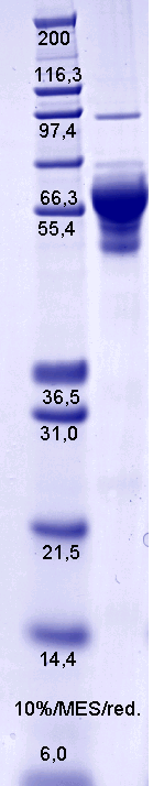 Proteros Product Image - DNA-Topoisomerase I (Vibrio cholerae) (1-599) 