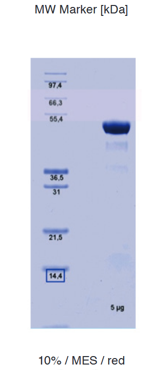 Proteros Product Image - Transglutaminase 2 (human) (1-462) 