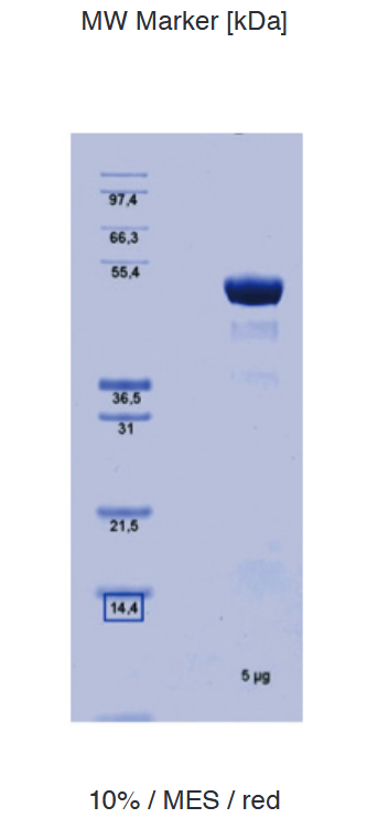 Proteros Product Image - Transglutaminase 2 (human) (1-464) 