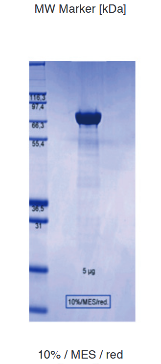 Proteros Product Image - Transglutaminase 2 (human) (1-687) 